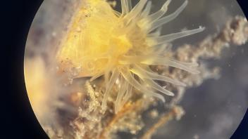 An embryonic sea urchin collected in water samples from Bodega Bay during UC Davis Pre-College Program